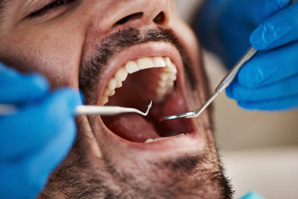 Best Emergency Dental Care for Abscessed Tooth in Port Clinton, OH
