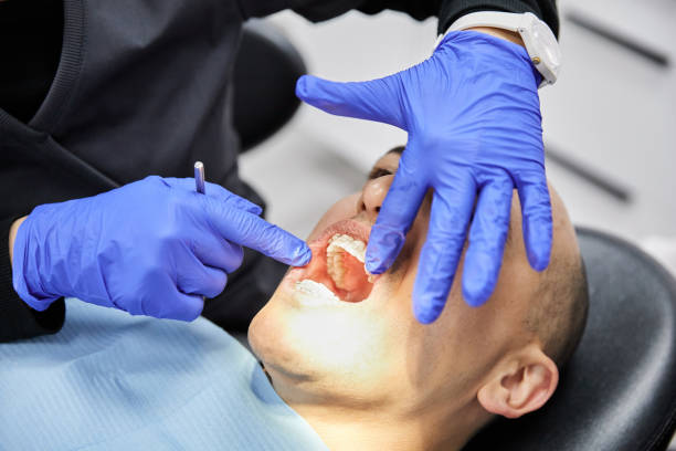 Best Emergency Dental Extractions in Port Clinton, OH